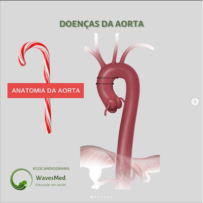 Anatomia da aorta Wavesmed 