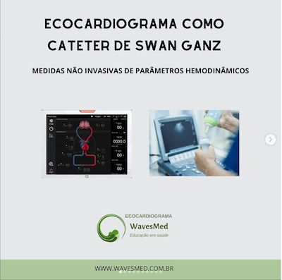 ECOCARDIOGRAMA COMO CATETER DE SWAN GANZ Wavesmed