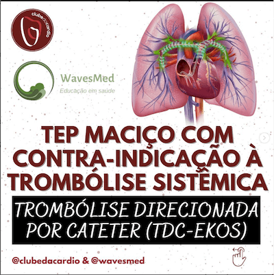 TEP MACIÇO COM CONTRA-INDICAÇÃO À TROMBOLISE SISTÈMICA
