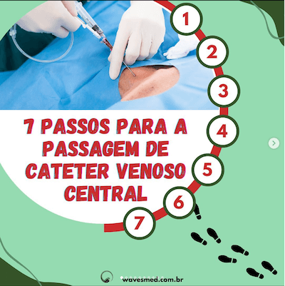 7 PASSOS PARA A PASSAGEM DE CATETER VENOSO CENTRAL Wavesmed