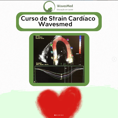 Curso de Strain Cardíaco Wavesmed