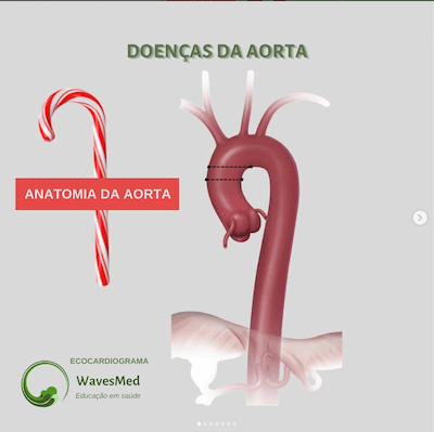 Anatomia da aorta