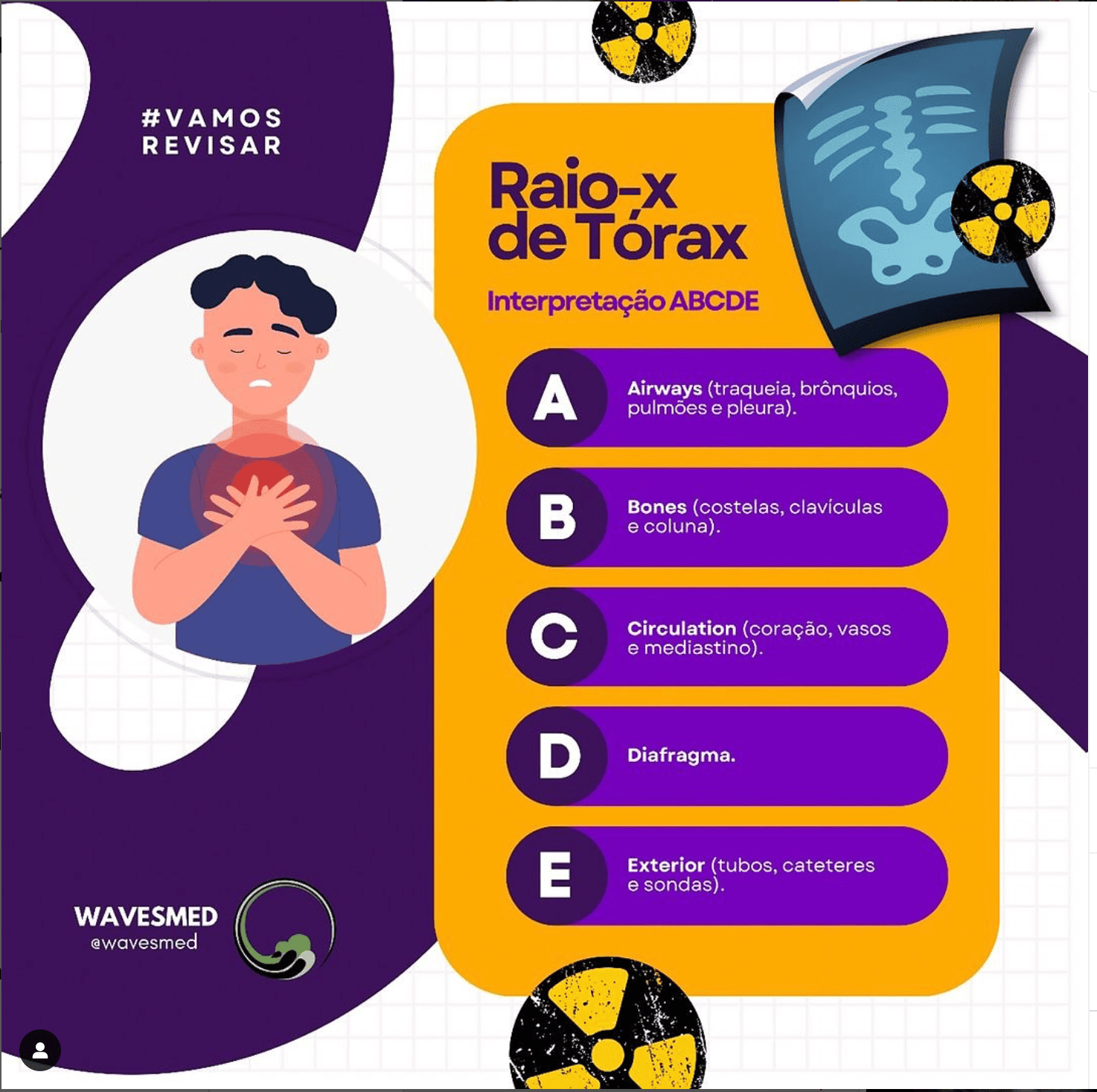  Revisar interpretação do RX tórax 
