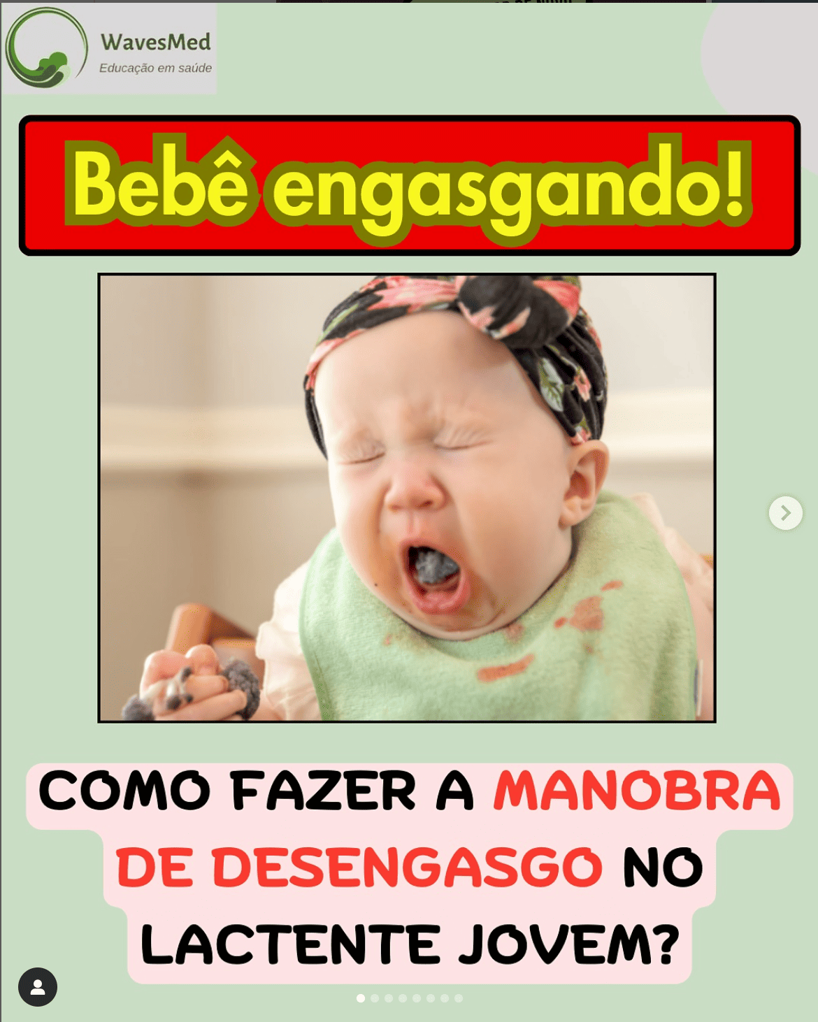 Como fazer a manobra do desengasgo em lactente jovem