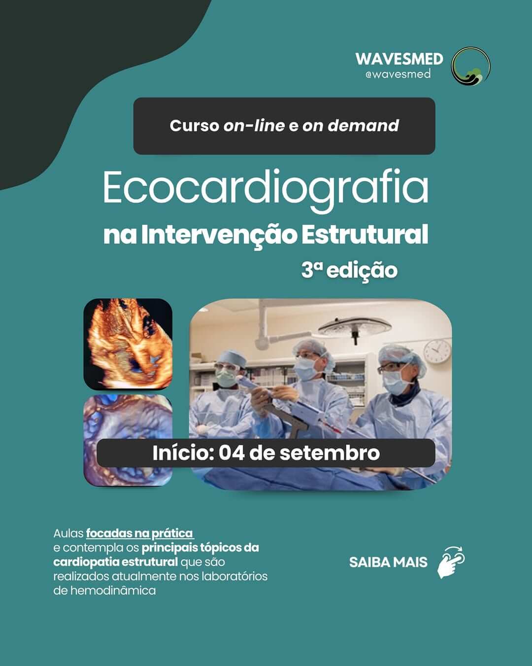 CURSO DE ECOCARDIOGRAFIA NA INTERVENÇÃO ESTRUTURAL