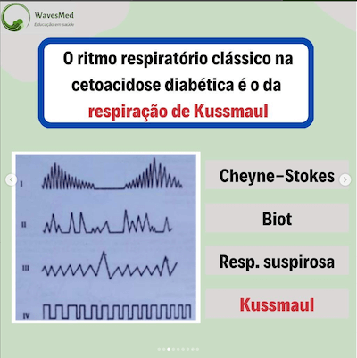 Kussmaul padrões respiratórios criança Wavesmed