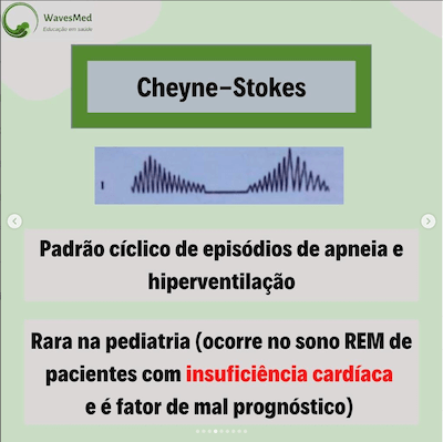 Cheyne Stokes padrões respiratórios criança Wavesmed