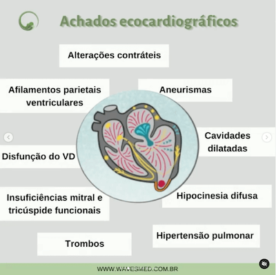 Achados miocardiopatia chagásica Wavesmed