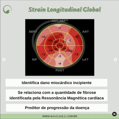 Strain miocardiopatia chagásica Wavesmed