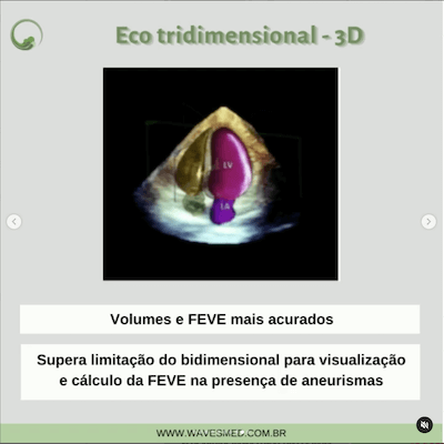 ECO 3D miocardiopatia chagásica Wavesmed