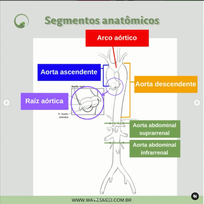Segmentos anatômicos anatomia aorta Wavesmed