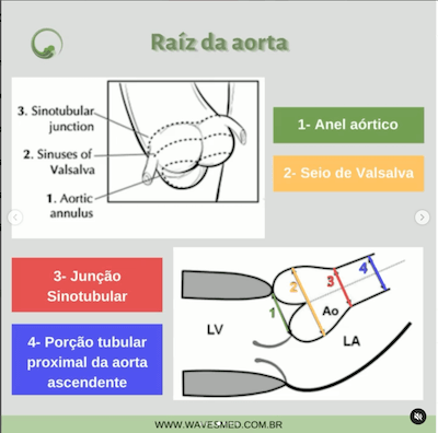 Raiz aorta anatomia aorta Wavesmed