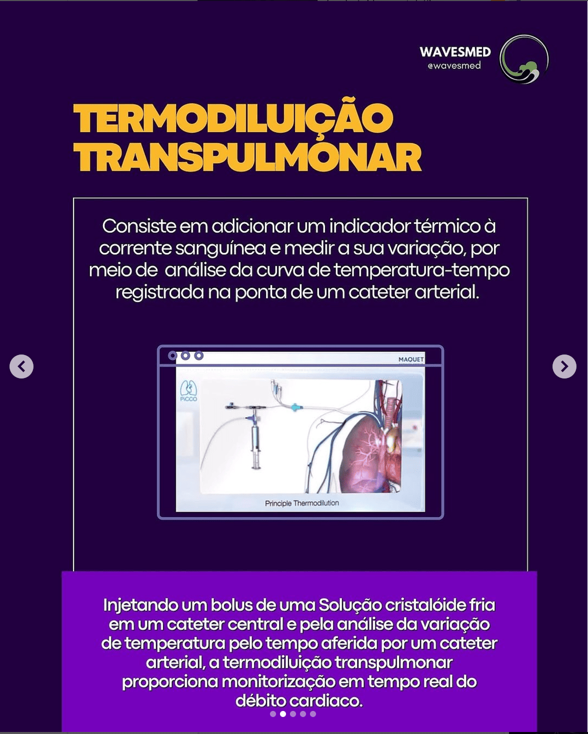 definição_TERMODILUIÇÃO_TRANSPULMONAR_Wavesmed