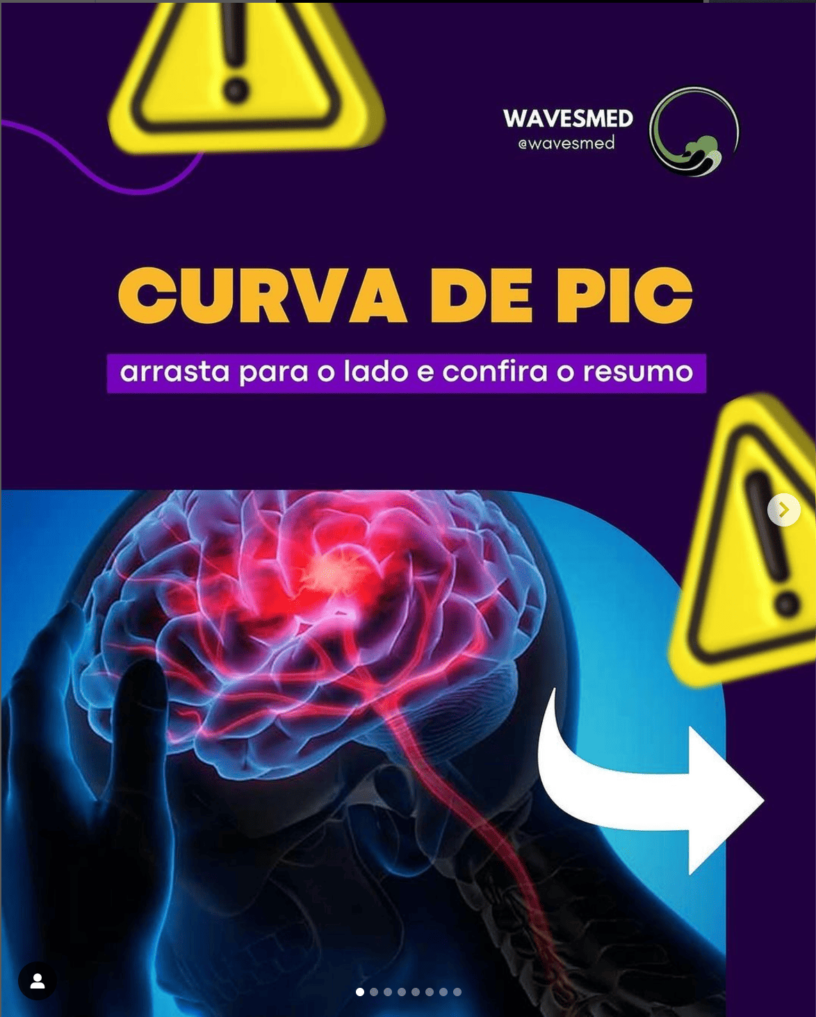 Curva de pressão Intracraniana Wavesmed