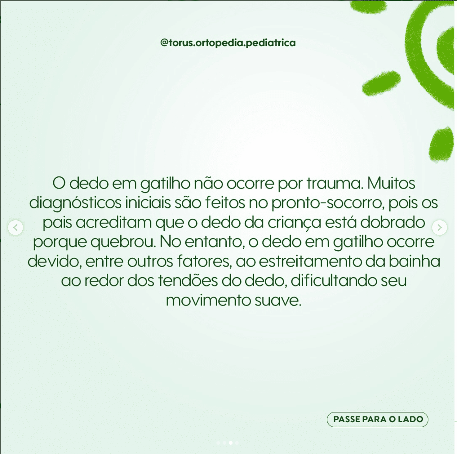 Causas dedo em gatilho congênito Wavesmed
