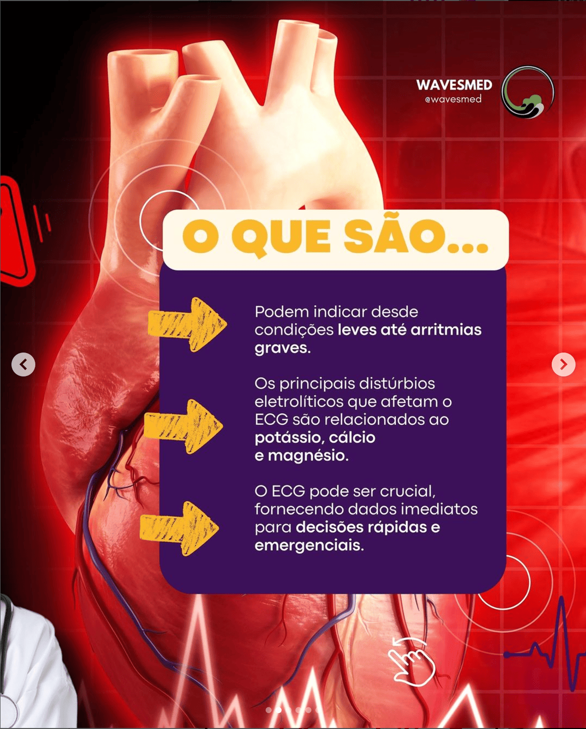 Alterações ECG distúrbios eletrolíticos ECG Wavesmed