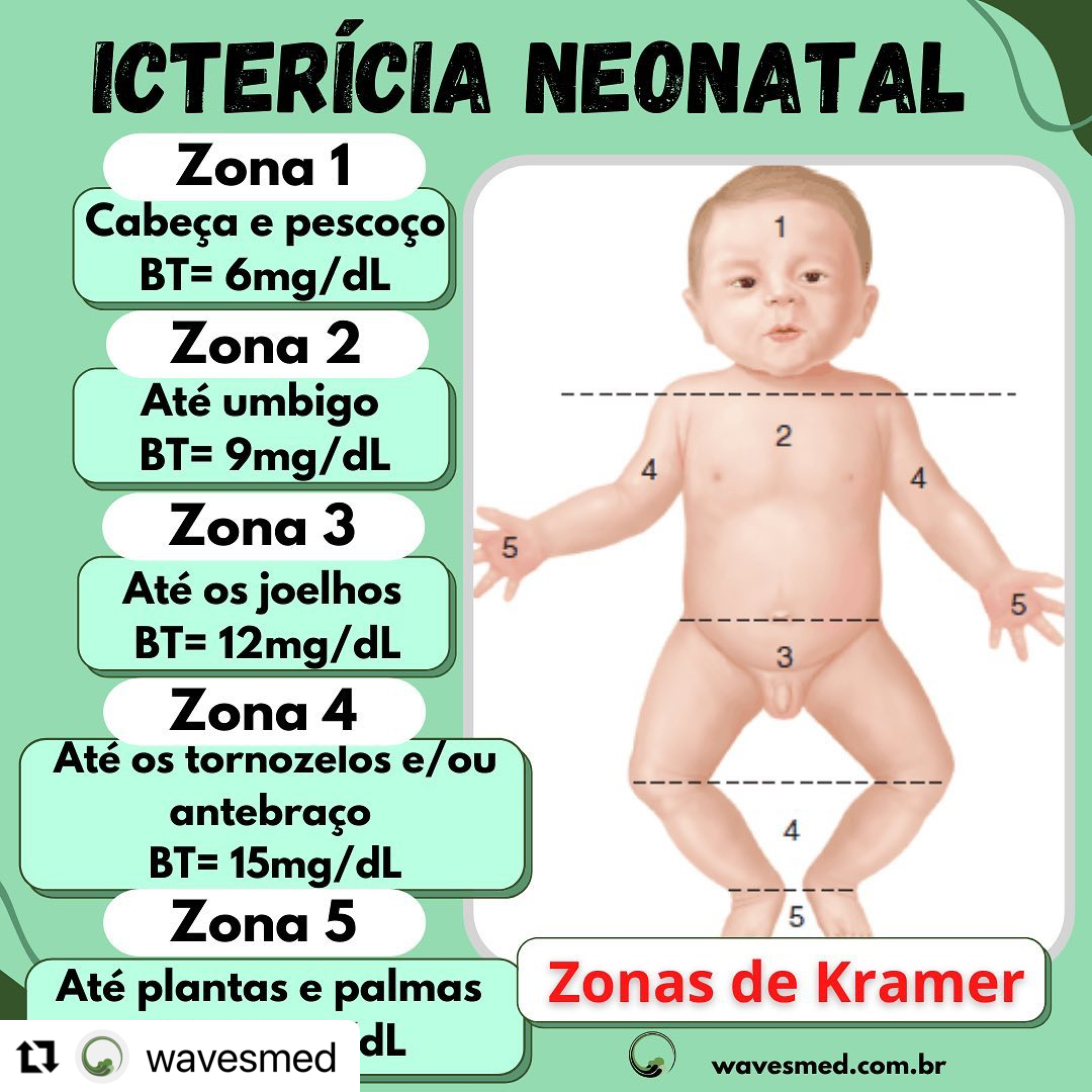 Icterícia e colestase neonatal