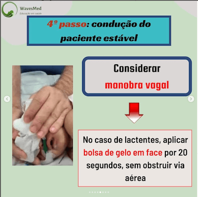 Taquicardia supraventricular Wavesmed  Considerar manobra vagal