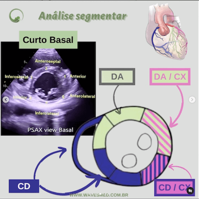 Função ventricular esquerda ecocardiograma Wavesmed  Análise coronária correspondente  Curto basal