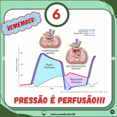 Pressão é perfusão  Atualizações PALS Parte 2 Wavesmed