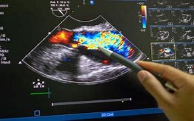 Videoteca em Ecocardiografia para a prova de título. 