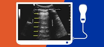 Curso teórico de Ultrassom de bolso para o clínico