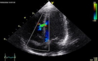Curso Preparatório para Prova de Título de Ecocardiografia - DIC